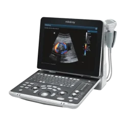 Echographe portable à ultrasons Mindray Z50 (couleur)