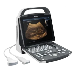 Echographe portable à ultrasons Mindray DP-10 (niveaux de gris)