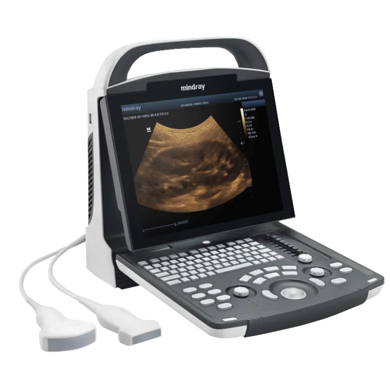 Echographe portable à ultrasons Mindray DP-10 (niveaux de gris)
