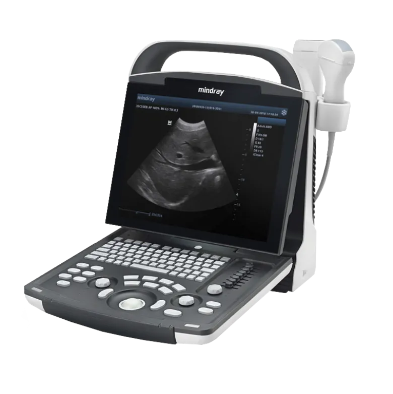 Echographe portable à ultrasons Mindray DP-10 (niveaux de gris)