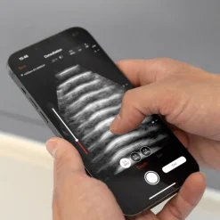 Echographe ultraportable connecté Echopen 01 (niveaux de gris)