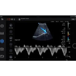 Echographe ultraportable connecté Edan Nano pour smartphone et tablette (couleur)