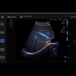 Echographe ultraportable connecté Edan Nano pour smartphone et tablette (couleur)