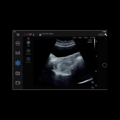 Echographe ultraportable connecté Edan Nano pour smartphone et tablette (couleur)