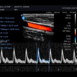 Echographe ultraportable connecté Edan Nano pour smartphone et tablette (couleur)