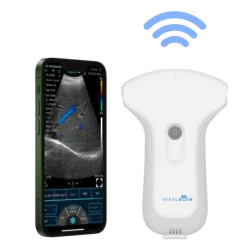 Echographe ultraportable connecté Vital Scan X3