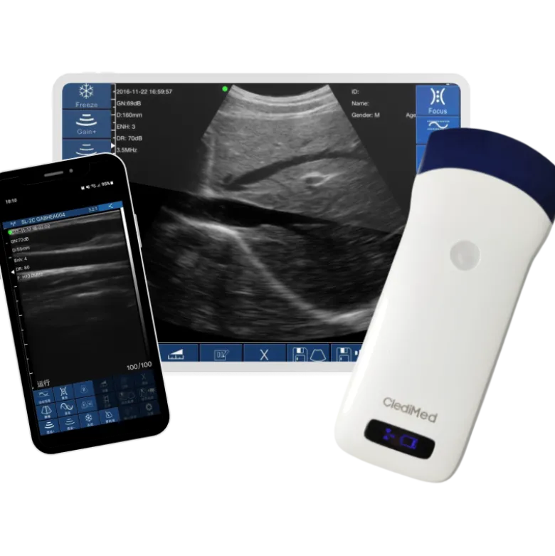 Echographe ultraportable connecté Wi-Fi ClediMed pour smartphone et tablette (couleur)