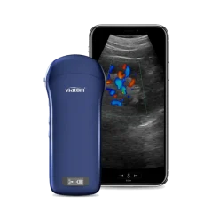 Echographe ultraportable connecté 3 en 1 Viatom sans fil (niveaux de gris)