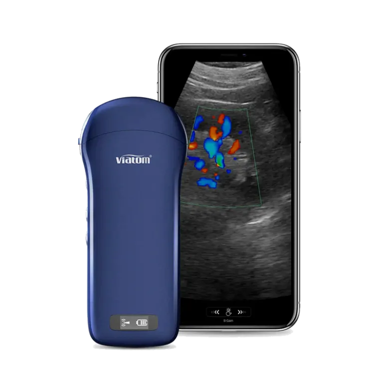 Echographe ultraportable connecté 3 en 1 Viatom sans fil (niveaux de gris)