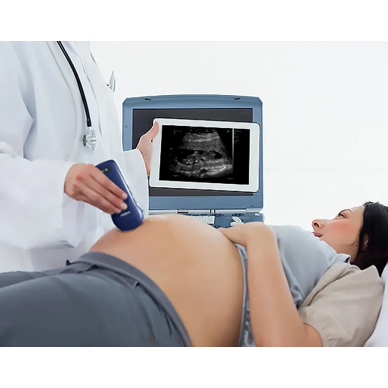 Echographe ultraportable connecté 3 en 1 Viatom sans fil (niveaux de gris)