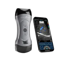 Echographe ultraportable connecté Vital Scan X5