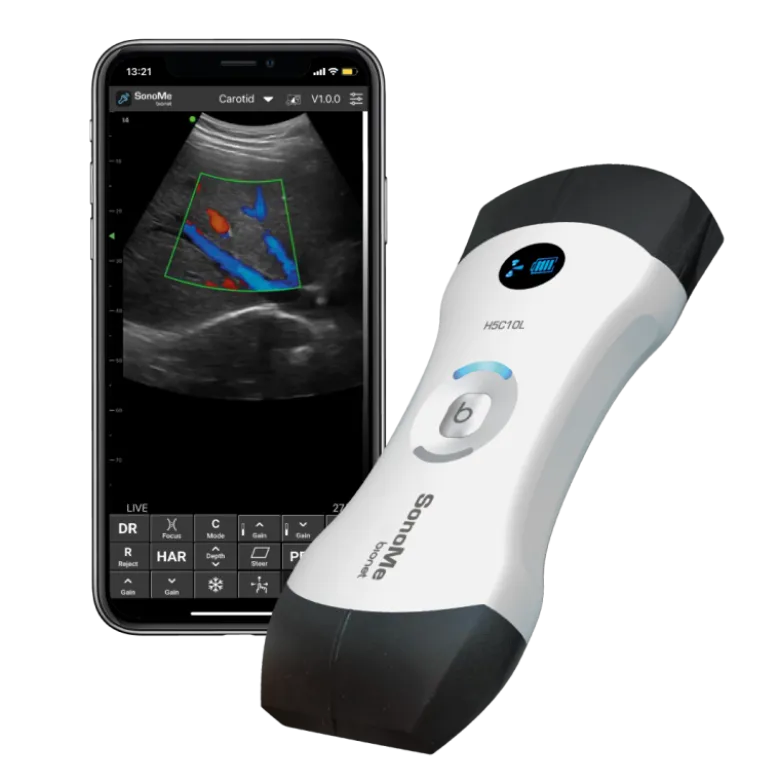 Echographe ultraportable connecté Bionet SonoMe