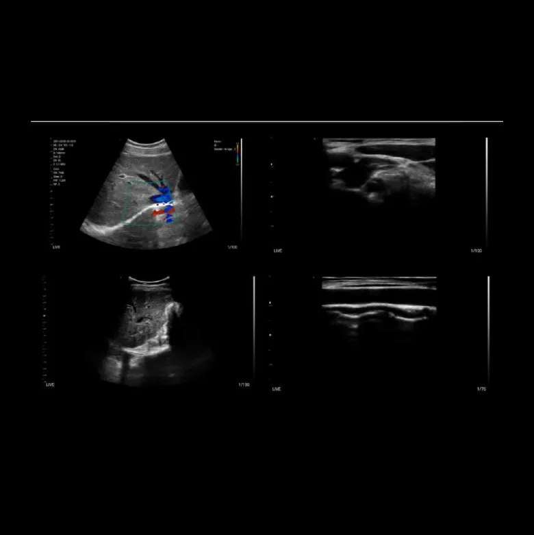 Echographe ultraportable connecté Bionet SonoMe