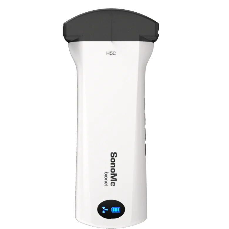 Echographe ultraportable connecté Bionet SonoMe