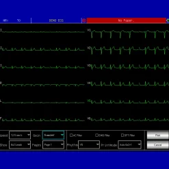 Electrocardiographe ECG Contec 1200G (12 pistes) avec interprétation