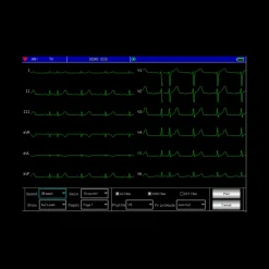 Electrocardiographe ECG Contec 1200G (12 pistes) avec interprétation