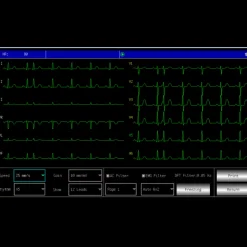 Electrocardiographe ECG Contec 600G (6 pistes) avec interprétation