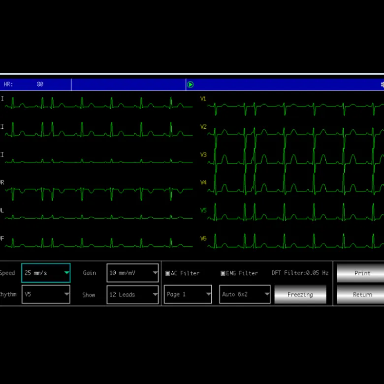Electrocardiographe ECG Contec 600G (6 pistes) avec interprétation