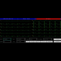 Electrocardiographe ECG Contec 600G (6 pistes) avec interprétation