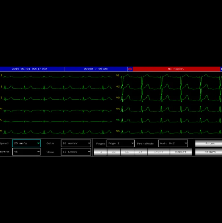Electrocardiographe ECG Contec 600G (6 pistes) avec interprétation