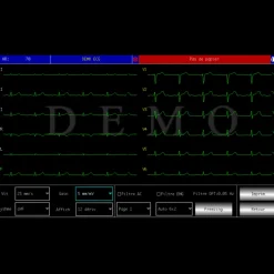 Electrocardiographe ECG Contec 600G (6 pistes) avec interprétation