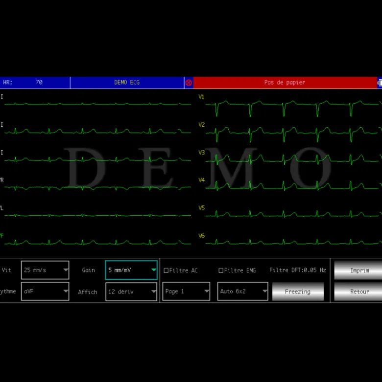 Electrocardiographe ECG Contec 600G (6 pistes) avec interprétation