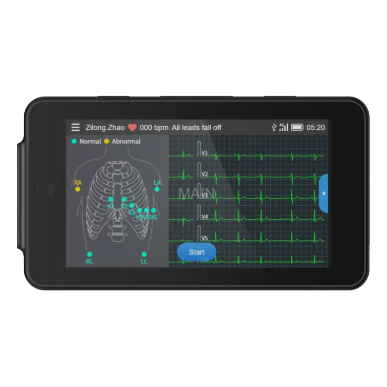 Electrocardiographe ECG de poche Cardio One Mini avec interprétation