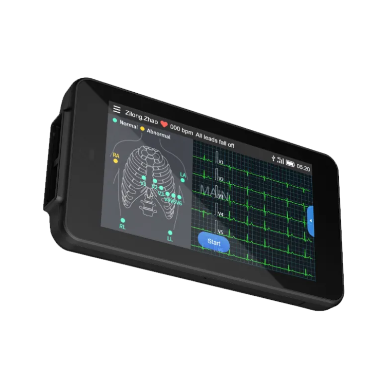 Electrocardiographe ECG de poche Cardio One Mini avec interprétation