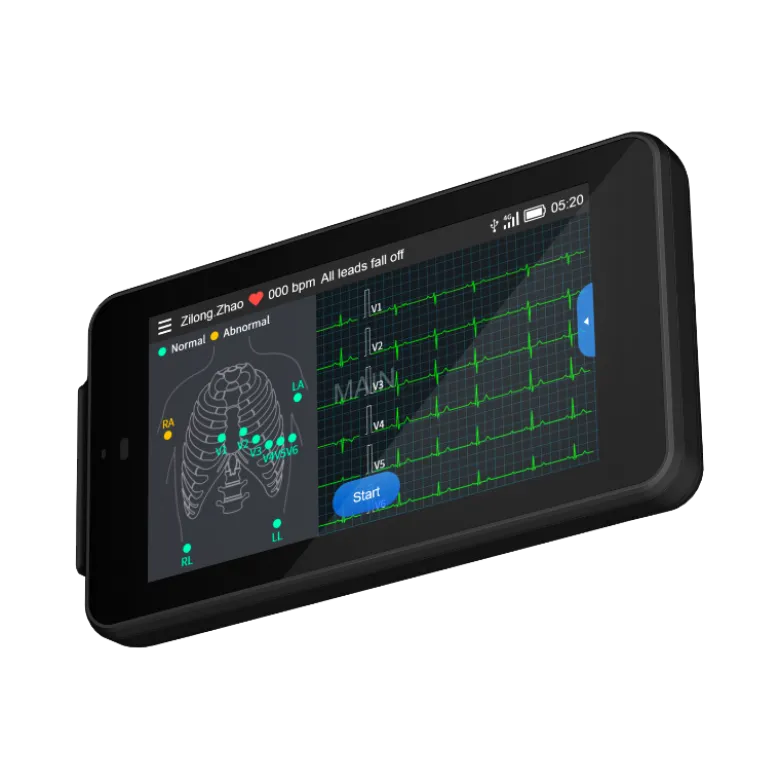 Electrocardiographe ECG de poche Cardio One Mini avec interprétation
