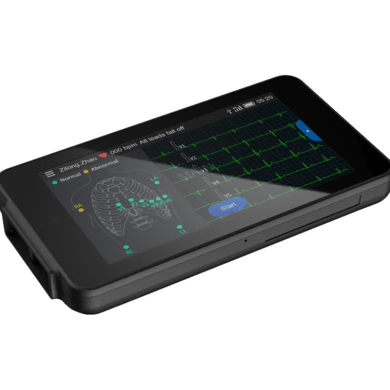 Electrocardiographe ECG de poche Cardio One Mini avec interprétation