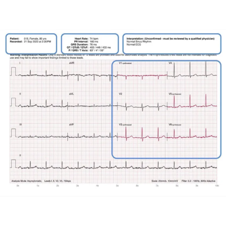 Electrocardiographe ECG de poche AliveCor Kardia 12L (12 pistes)
