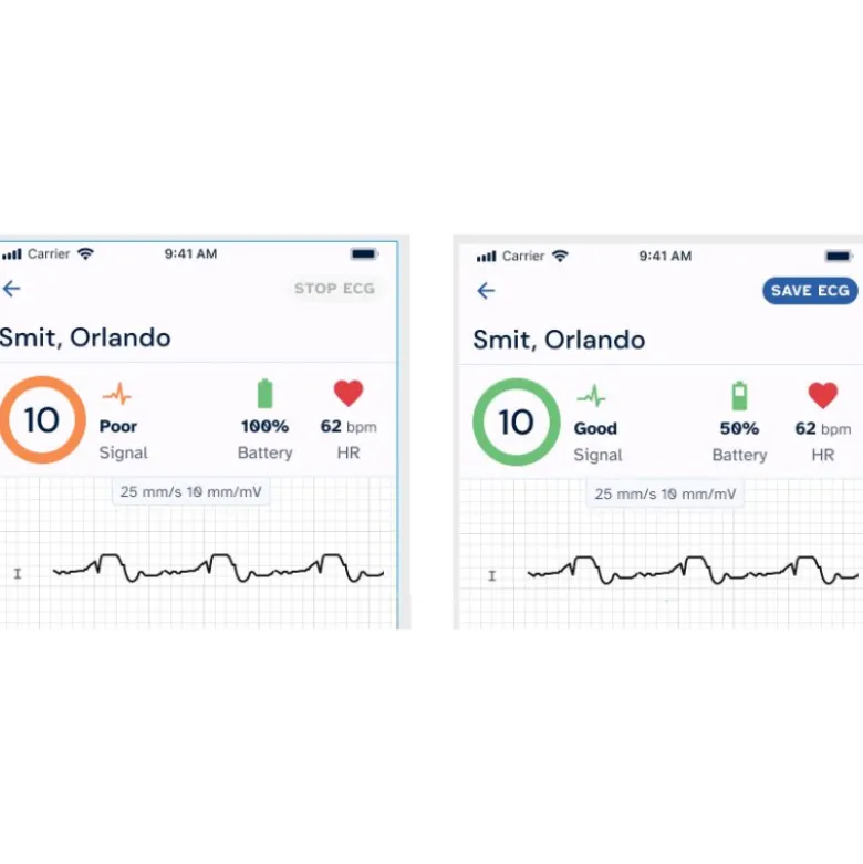 Electrocardiographe ECG de poche AliveCor Kardia 12L (12 pistes)