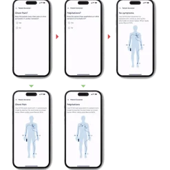 Electrocardiographe ECG de poche AliveCor Kardia 12L (12 pistes)