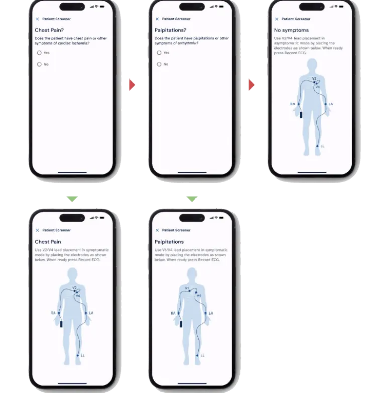 Electrocardiographe ECG de poche AliveCor Kardia 12L (12 pistes)