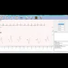 Electrocardiographe ECG Edan PC SE 1010 Numérique (USB)