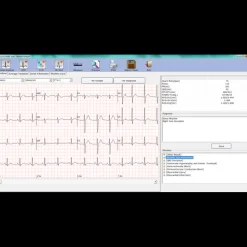 Electrocardiographe ECG Edan PC SE 1010 Numérique (USB)