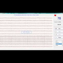 Electrocardiographe ECG Edan PC SE 1010 Numérique (USB)