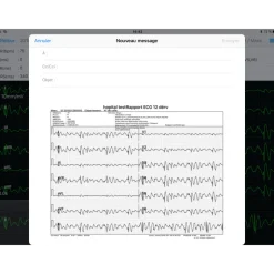 Electrocardiographe ECG Edan PADECG Numérique sans fil pour iPad avec interprétation