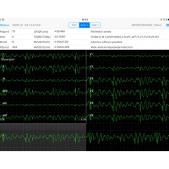 Electrocardiographe ECG Edan PADECG Numérique sans fil pour iPad avec interprétation