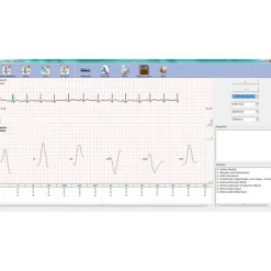 Electrocardiographe ECG Edan PC SE 1010 Numérique (sans fil Bluetooth)
