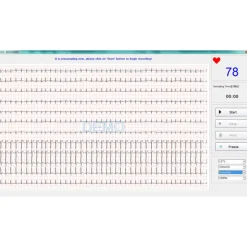 Electrocardiographe ECG Edan PC SE 1010 Numérique (sans fil Bluetooth)