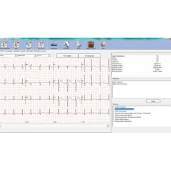 Electrocardiographe ECG Edan PC SE 1010 Numérique (sans fil Bluetooth)