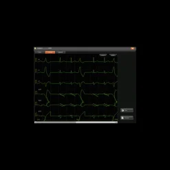 Electrocardiographe ECG Edan SE-1202 (12 pistes) avec interprétation