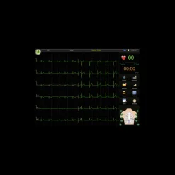 Electrocardiographe ECG Edan SE-1202 (12 pistes) avec interprétation