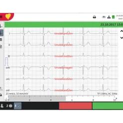 Electrocardiographe ECG Schiller FT-1 Cardiovit (6 pistes)