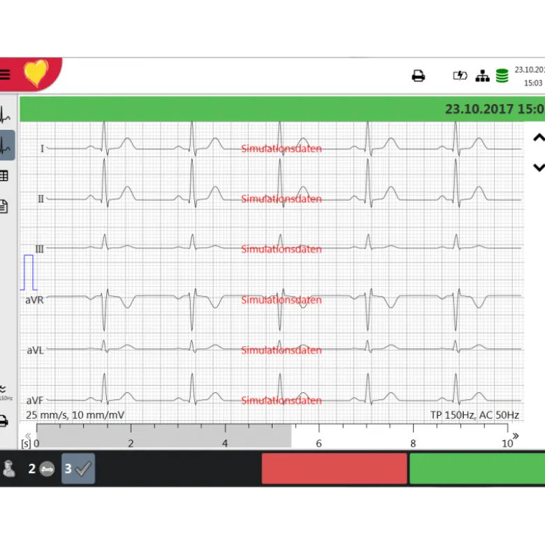 Electrocardiographe ECG Schiller FT-1 Cardiovit (6 pistes)