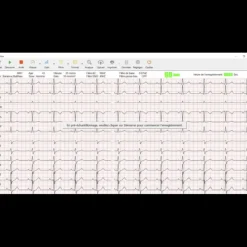 Electrocardiographe ECG Spengler Cardiomate PC-ECG (12 pistes) avec interprétation