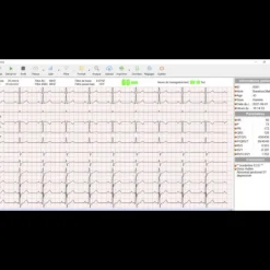 Electrocardiographe ECG Spengler Cardiomate PC-ECG (12 pistes) avec interprétation