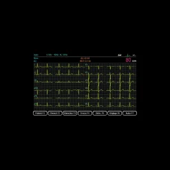 Electrocardiographe ECG Spengler Cardiomate 12 (12 pistes) avec interprétation