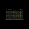 Electrocardiographe ECG Spengler Cardiomate 6 (6 pistes) avec interprétation